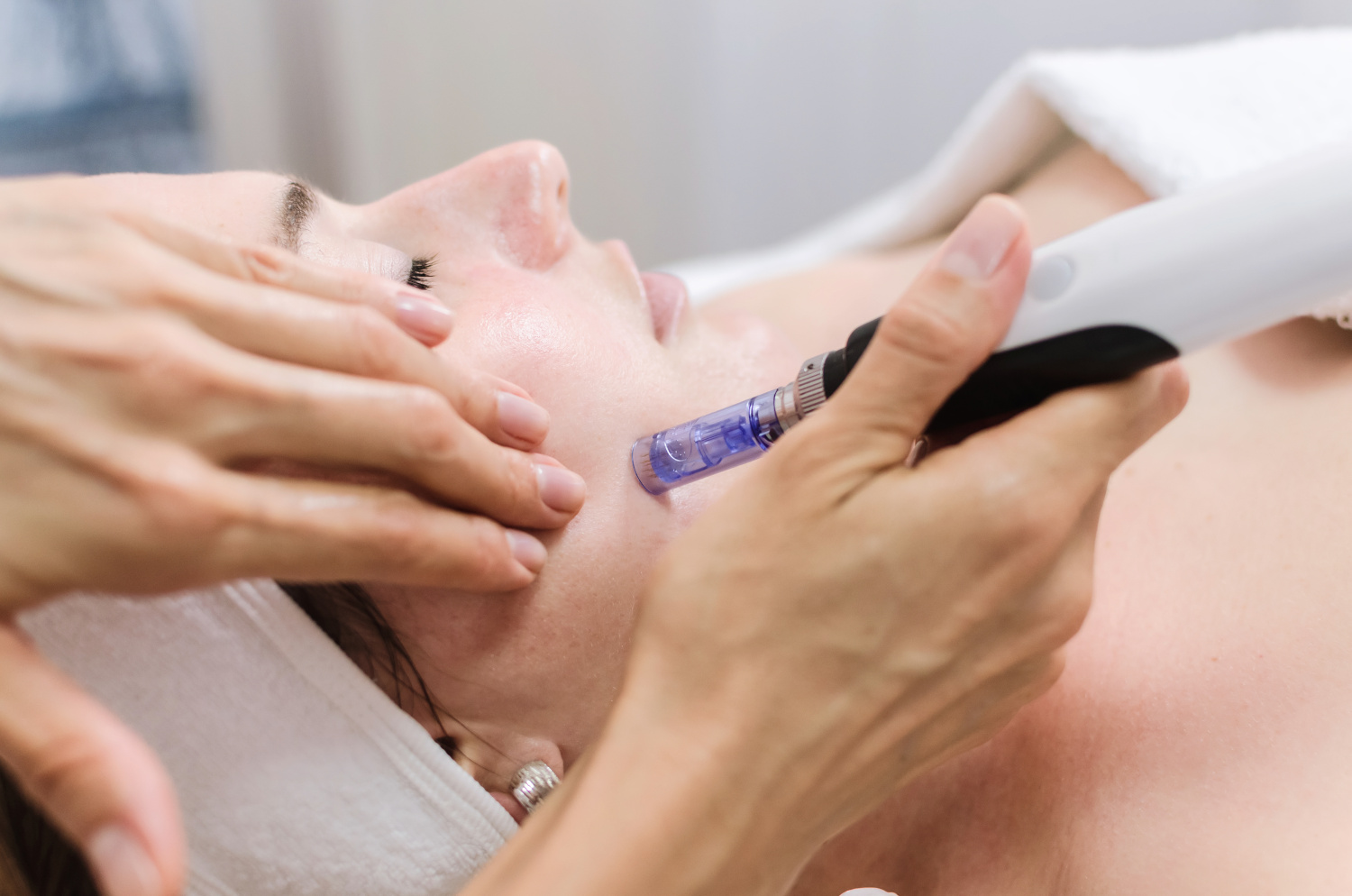Dermapen Spa-Behandlung